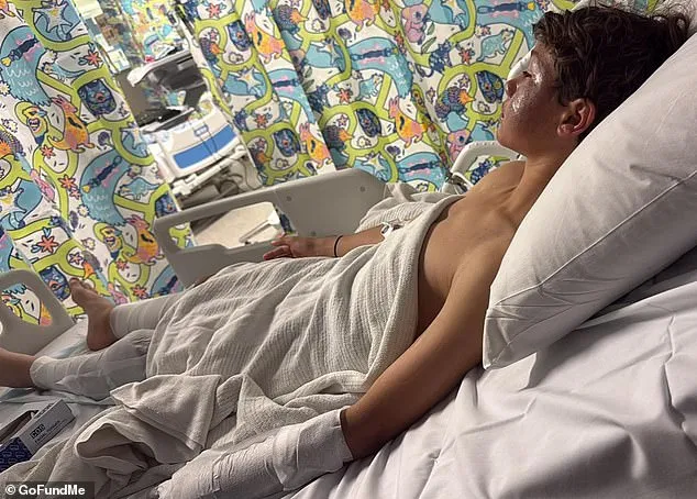 Lucas suffered serious burns following a 'mindless' prank. He is pictured recovering in hospital