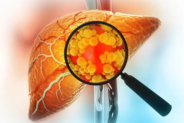 Magnifying Glass Showing Diseased Liver