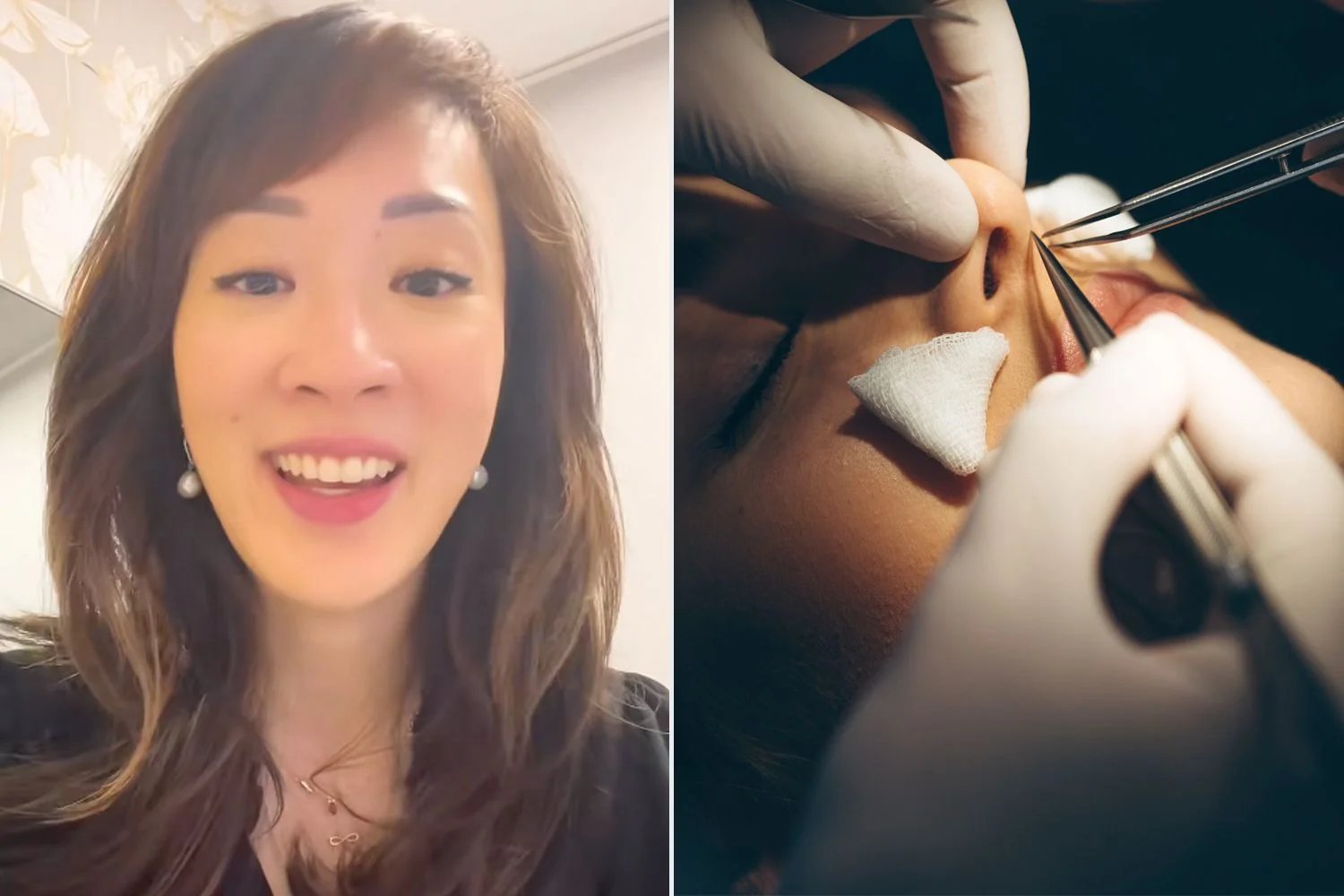 Plastic Surgeon Explains Why She Turns Down Patients Seeking Nose Jobs Exclusive